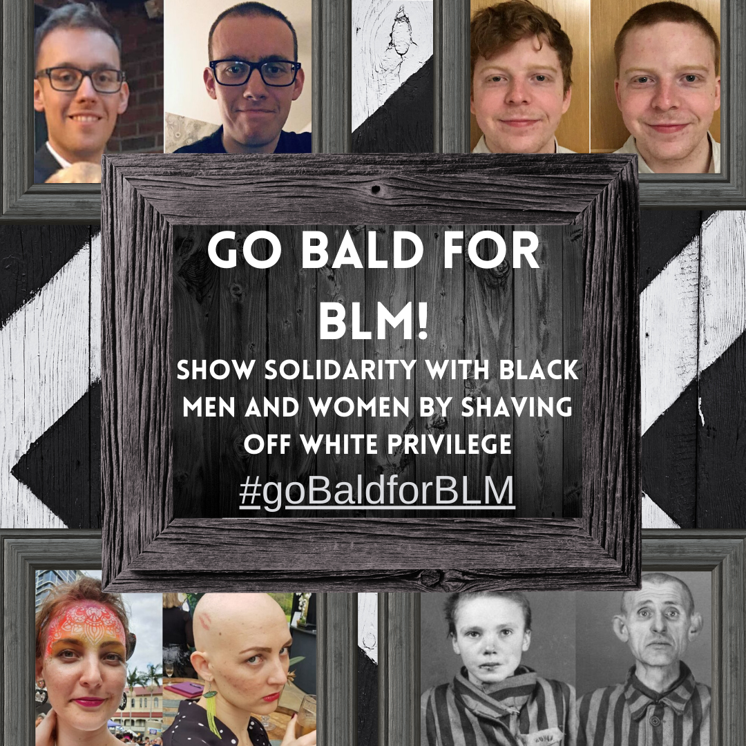 gobaldforblm