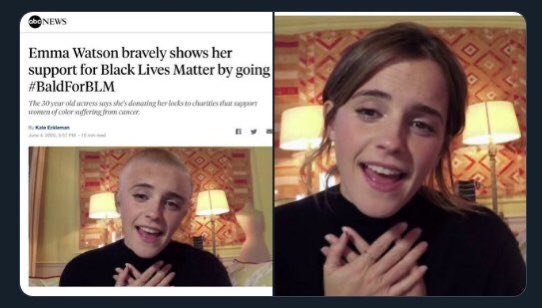 #gobaldforblm