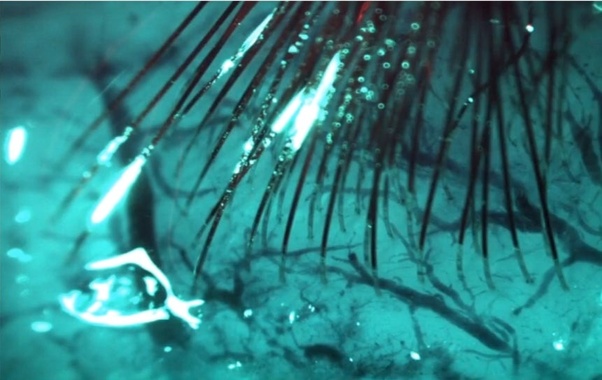 neuralink brain